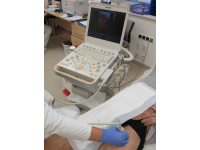 Ultrazvukové vyšetření cév