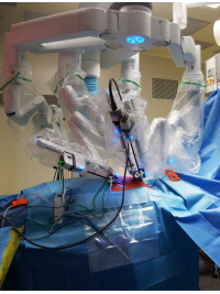 Robotická chirurgie – operační ramena zavedená do hrudníku operovaného